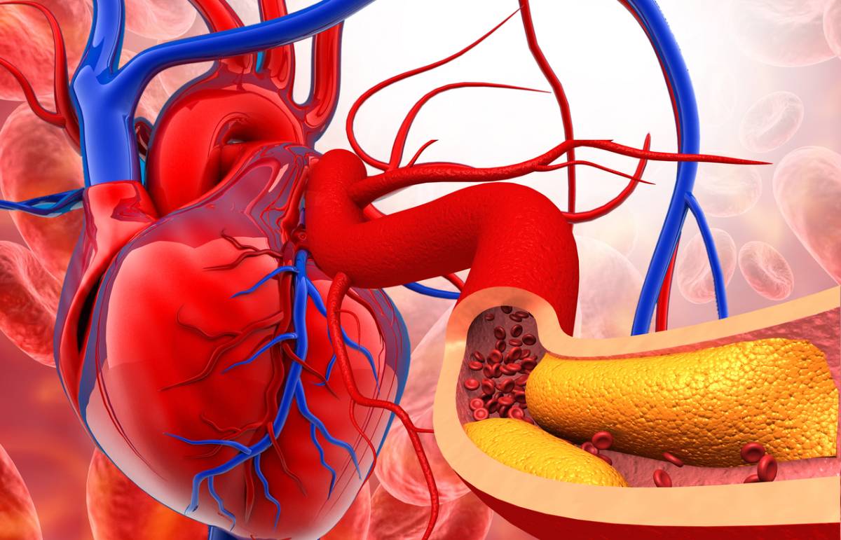 concept of most common vein problems